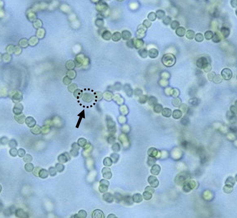 イシクラゲの顕微鏡写真。多数の球状の個体がネックレス上につながっている。