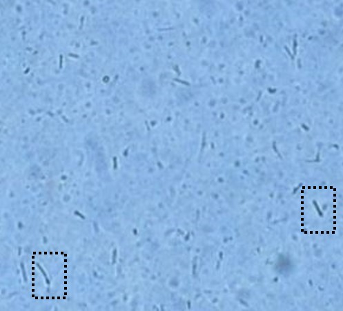 乳酸菌の写真