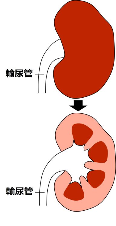 腎臓の断面を描いた図。詳細は、のちに解説。