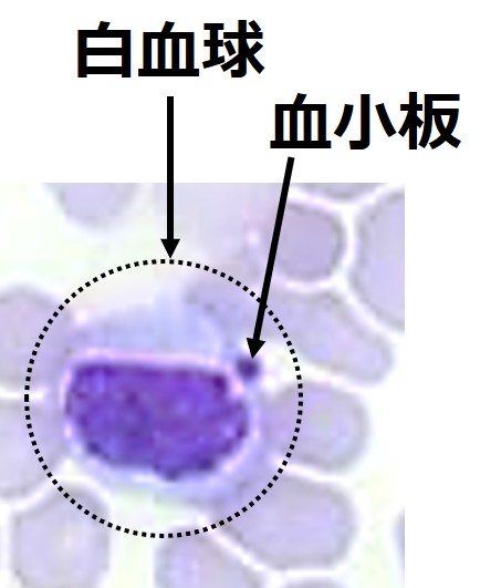 ヒトの白血球の写真