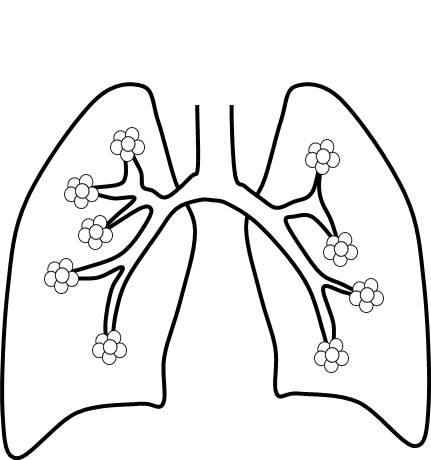 肺内では、枝分かれした管の先に、球状の構造が集まっていることを描いた図