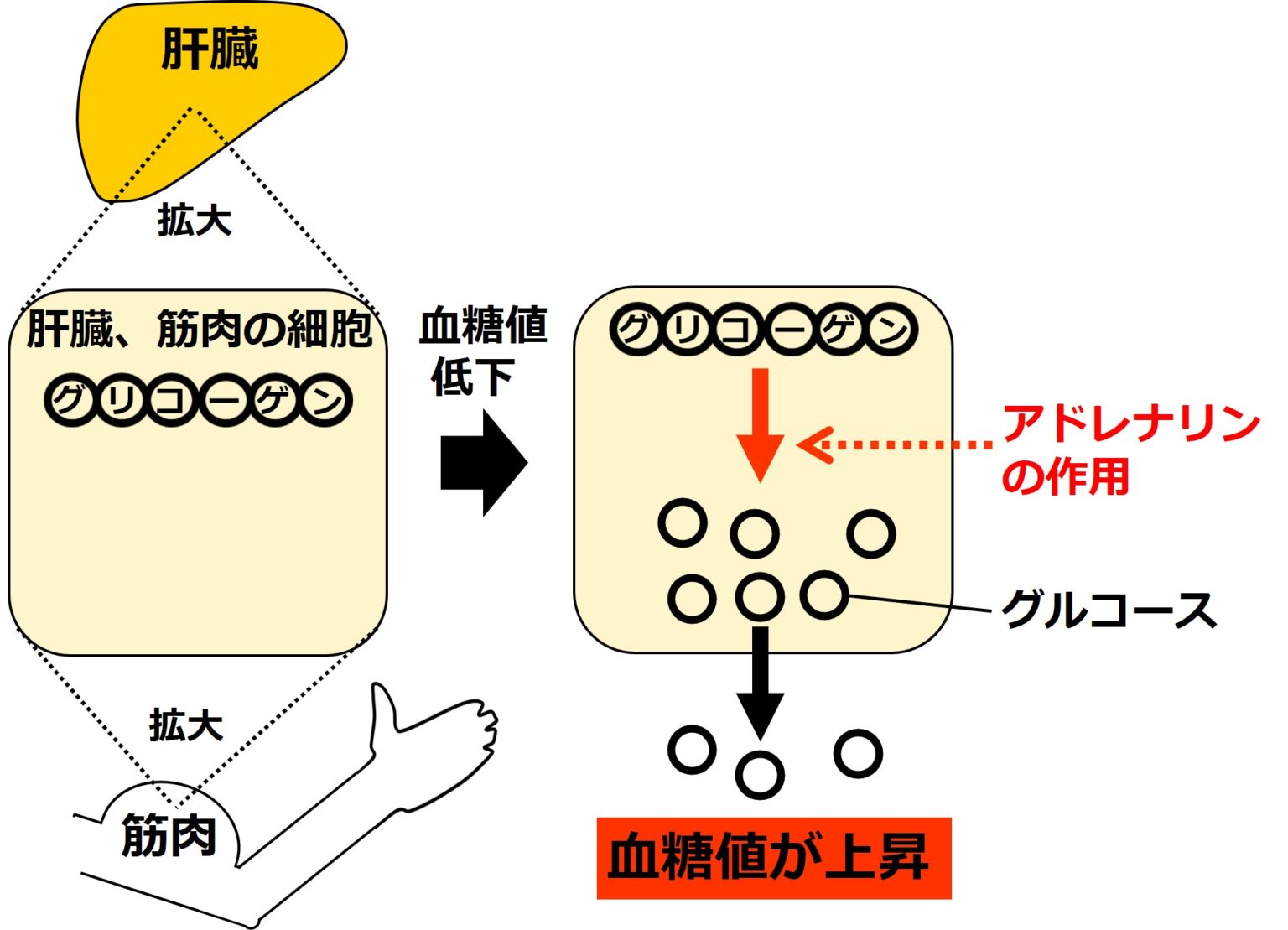 低血糖の症状は何ですか?